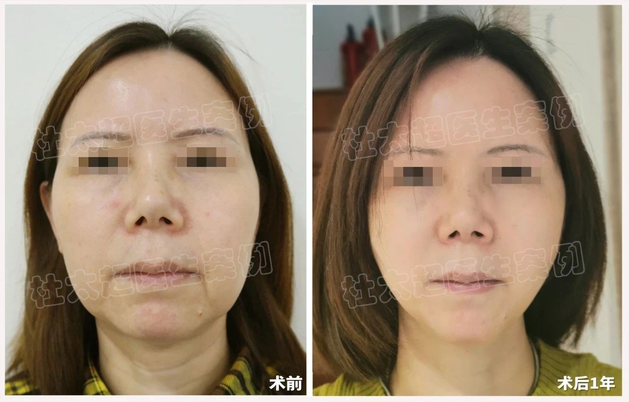 1745105252967304.jpg 微信图片_20250420072458.jpg