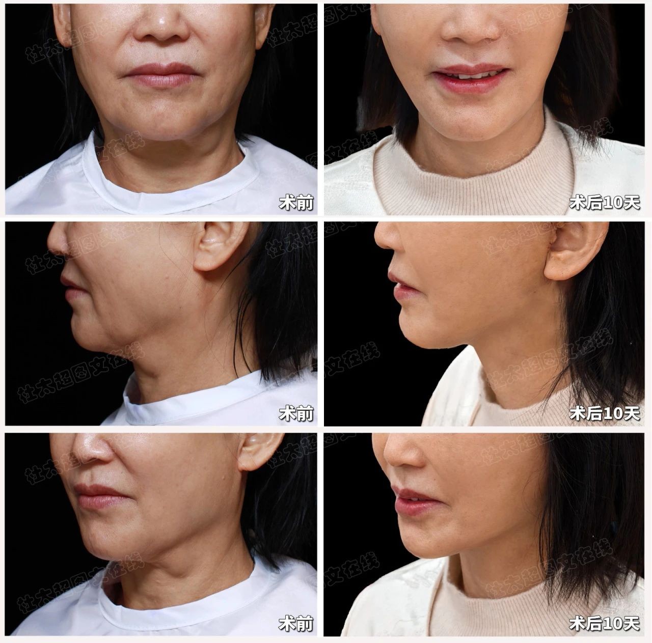 1745583114119964.jpg 微信图片_20250425193810.jpg