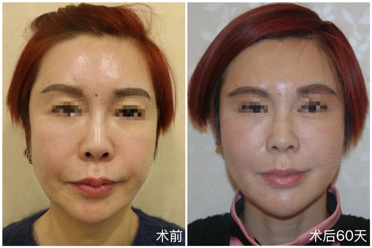 1745676654158428.jpg 微信图片_20250426221102.jpg