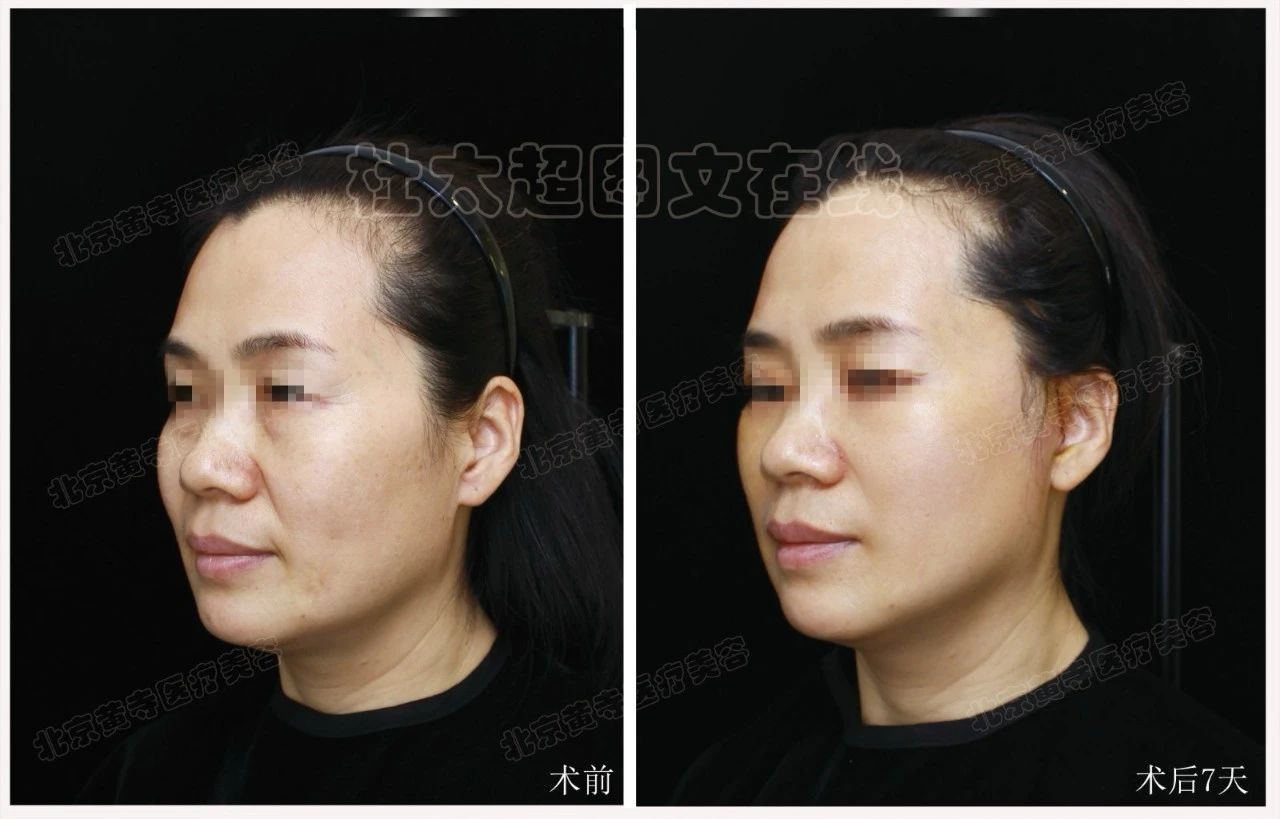 1746060354240571.jpg 微信图片_20250501084401.jpg