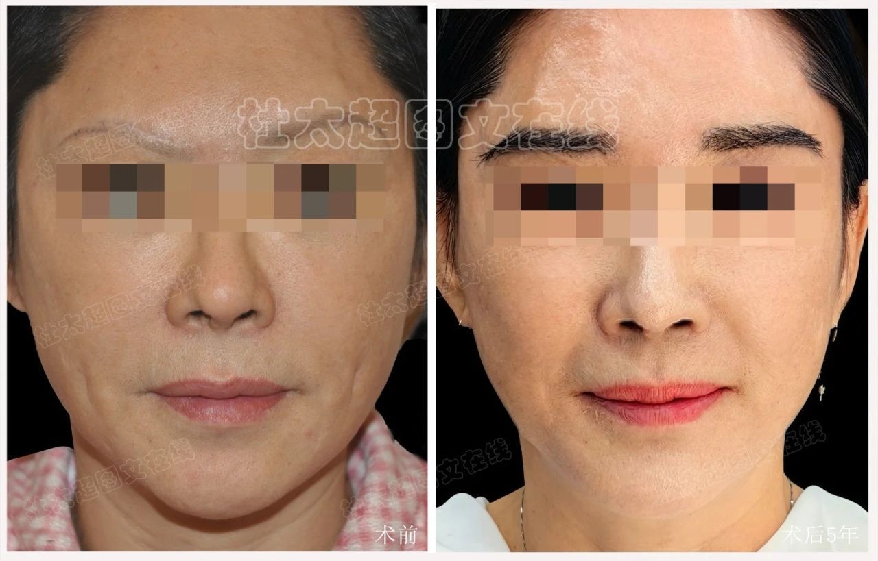 1746692126203056.jpg 微信图片_20250508161431.jpg