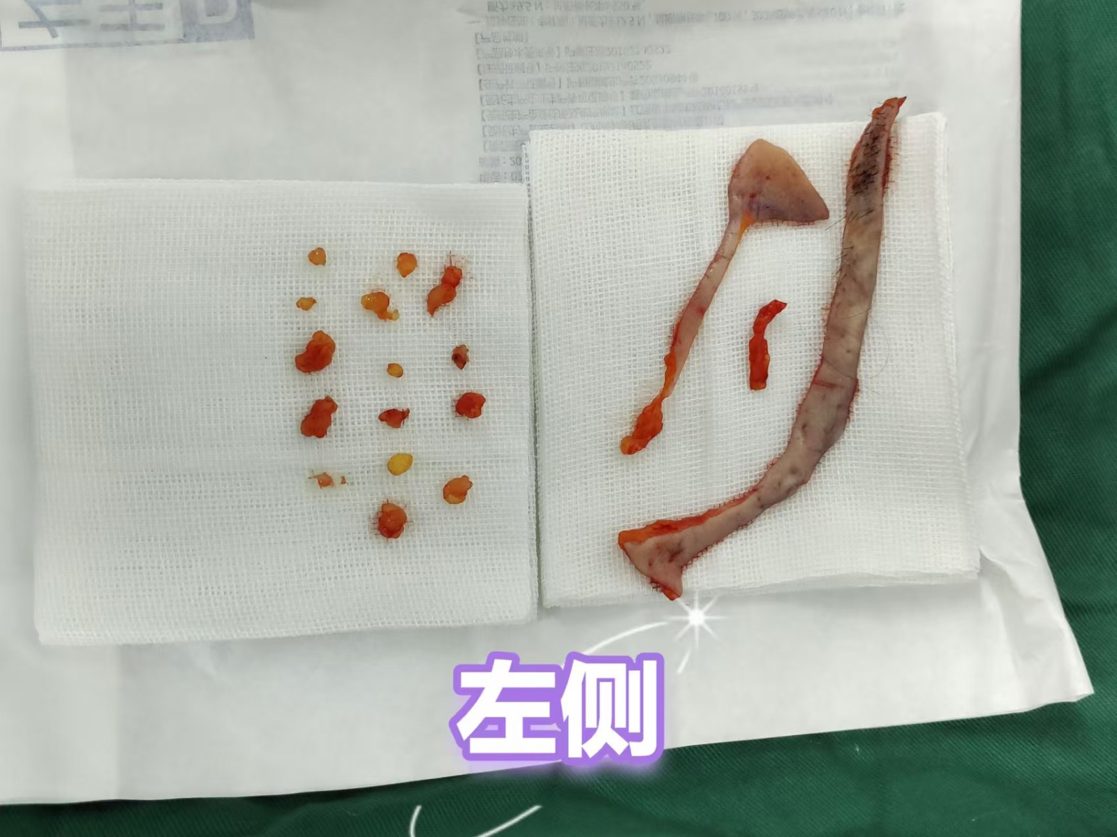 1746839121139944.jpg 微信图片_20250510083348.jpg