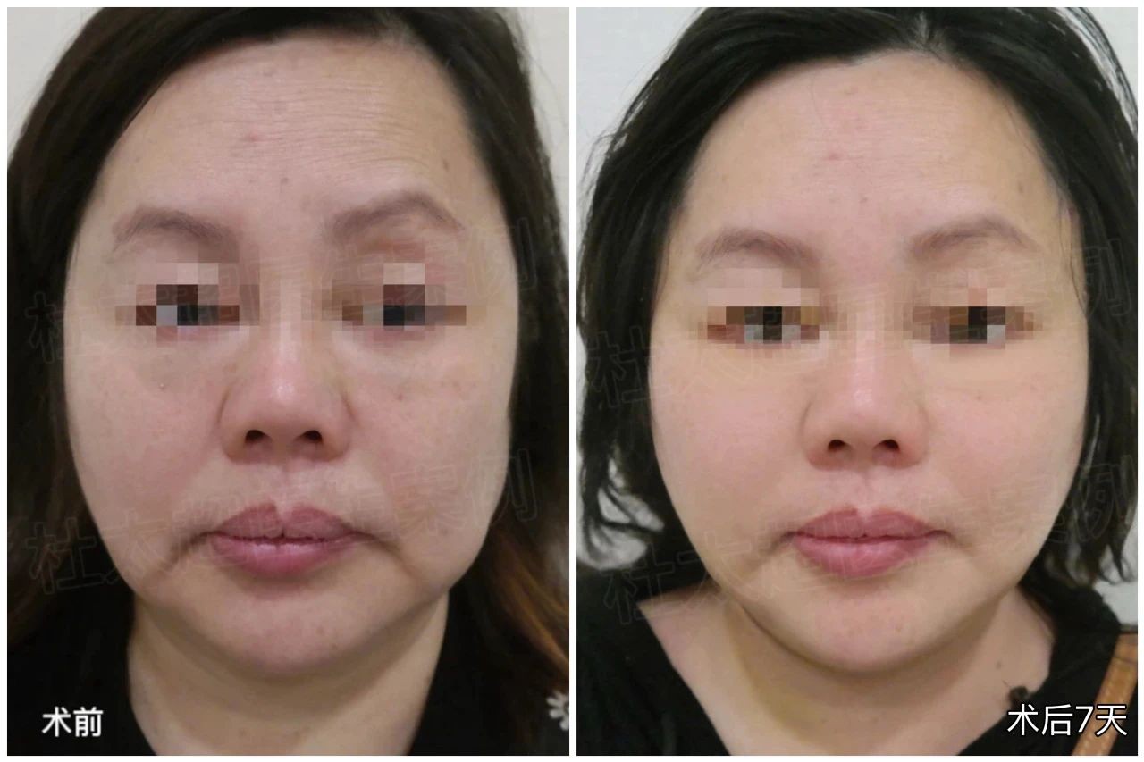 1747216979216686.jpg 微信图片_20250514180209.jpg