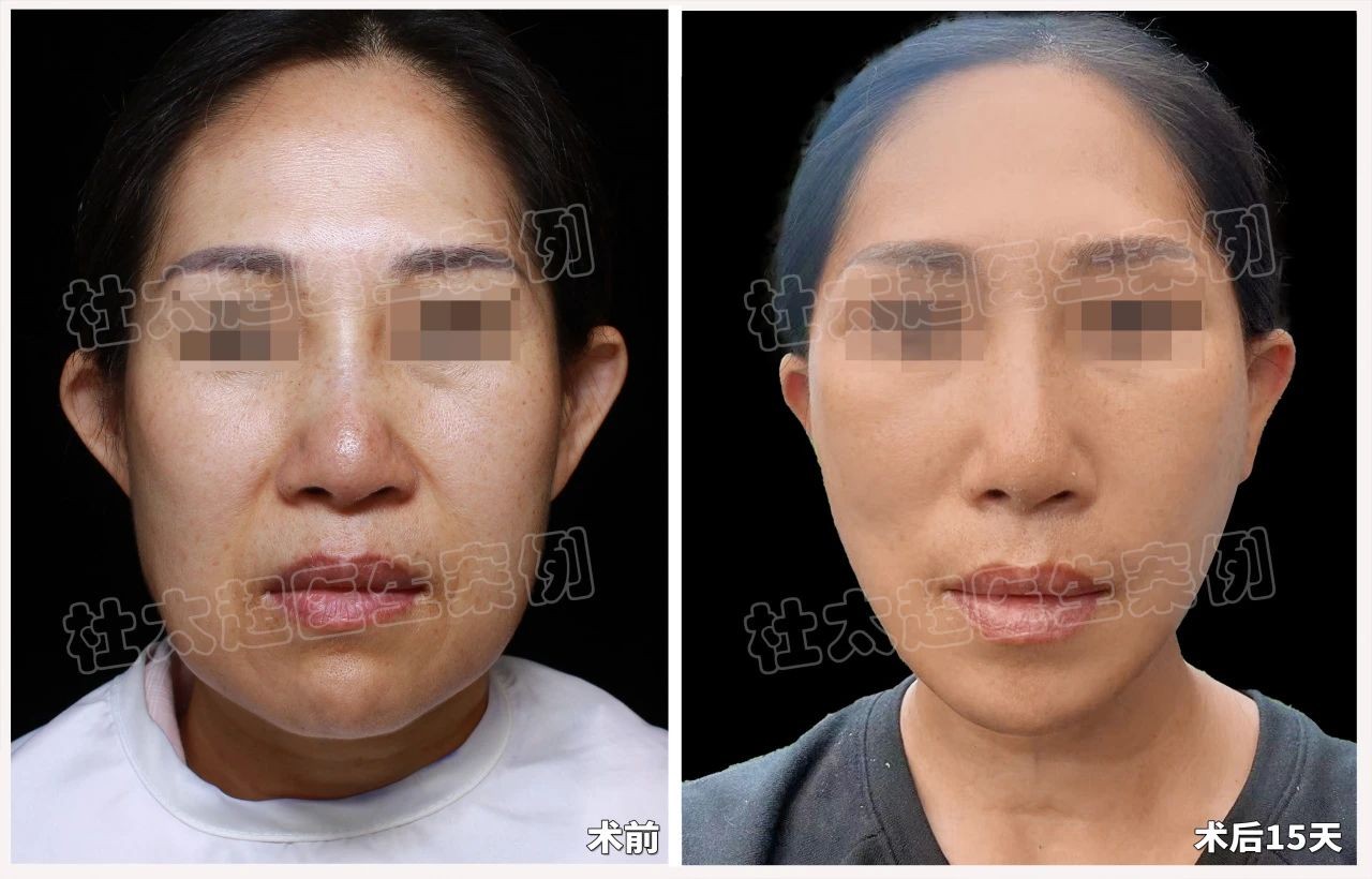 1748997767518461.jpg 微信图片_20250604084145.jpg