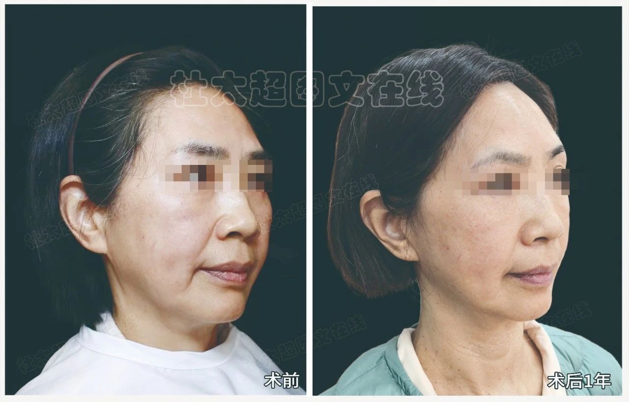 1749964973134932.jpg 微信图片_20250615132027.jpg