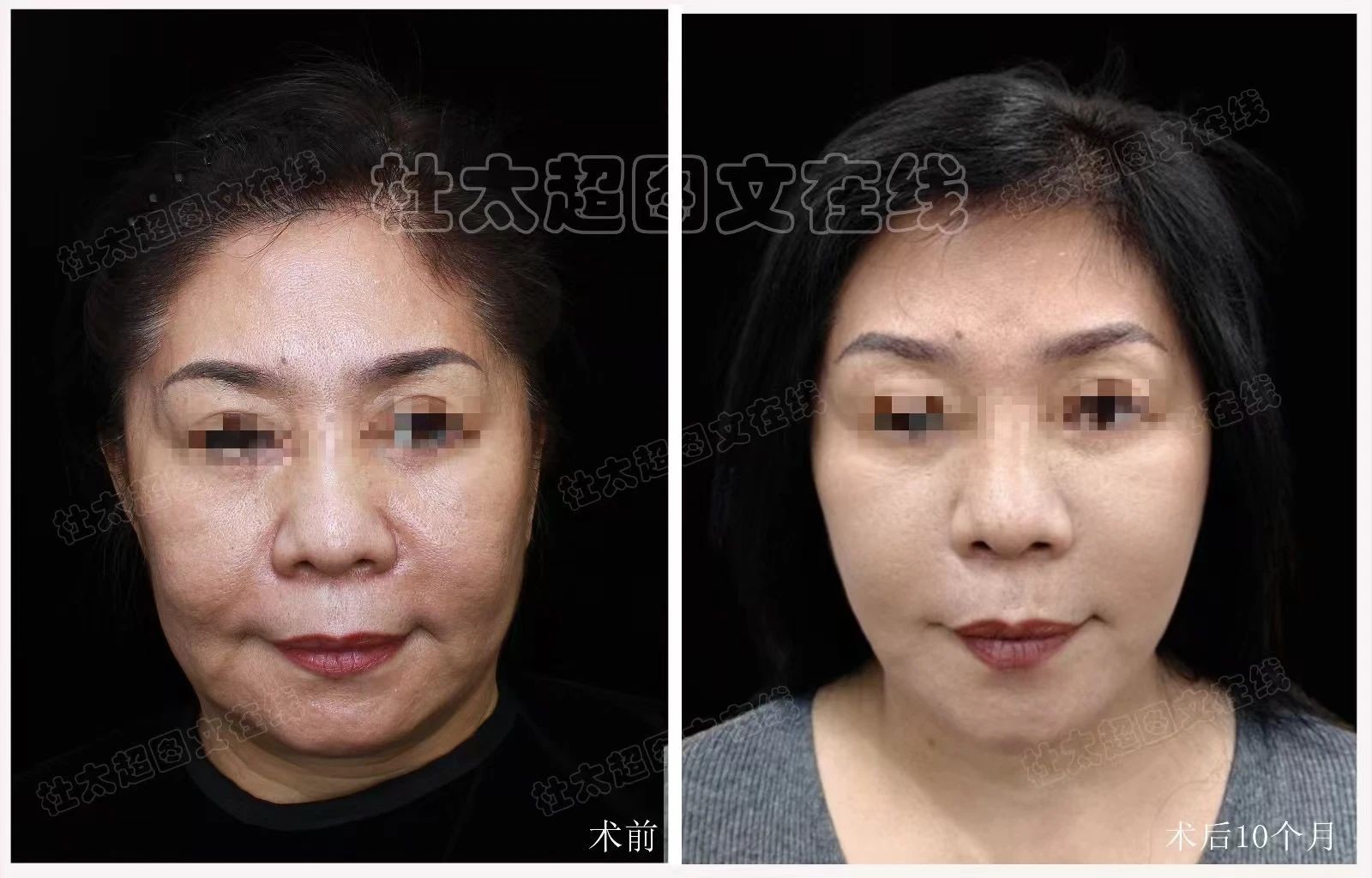 1753497761177719.jpg 微信图片_20250726103932.jpg