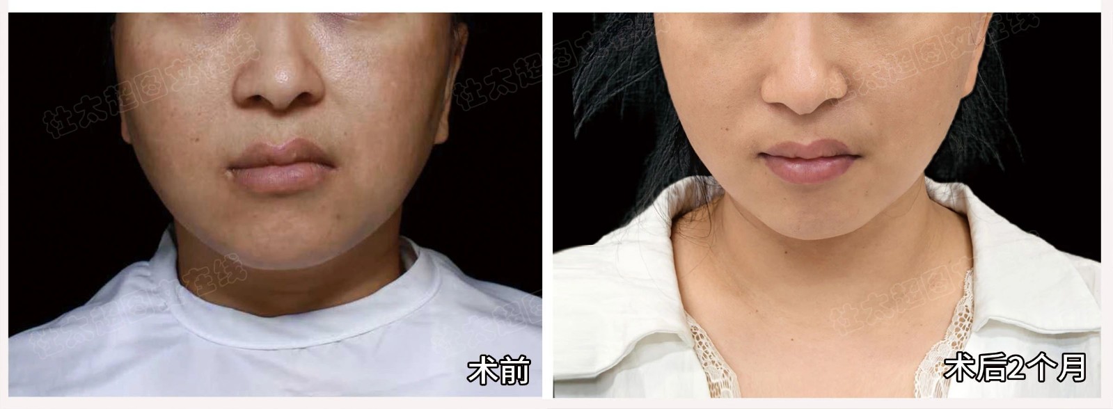 1756375608182568.jpg 微信图片_2025-08-28_180408_781.jpg