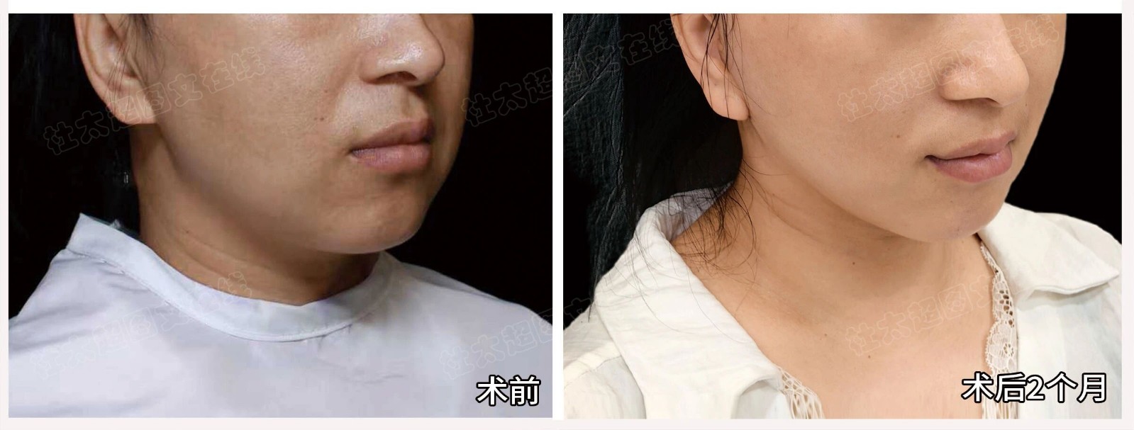 1756375673142639.jpg 微信图片_2025-08-28_180418_322.jpg