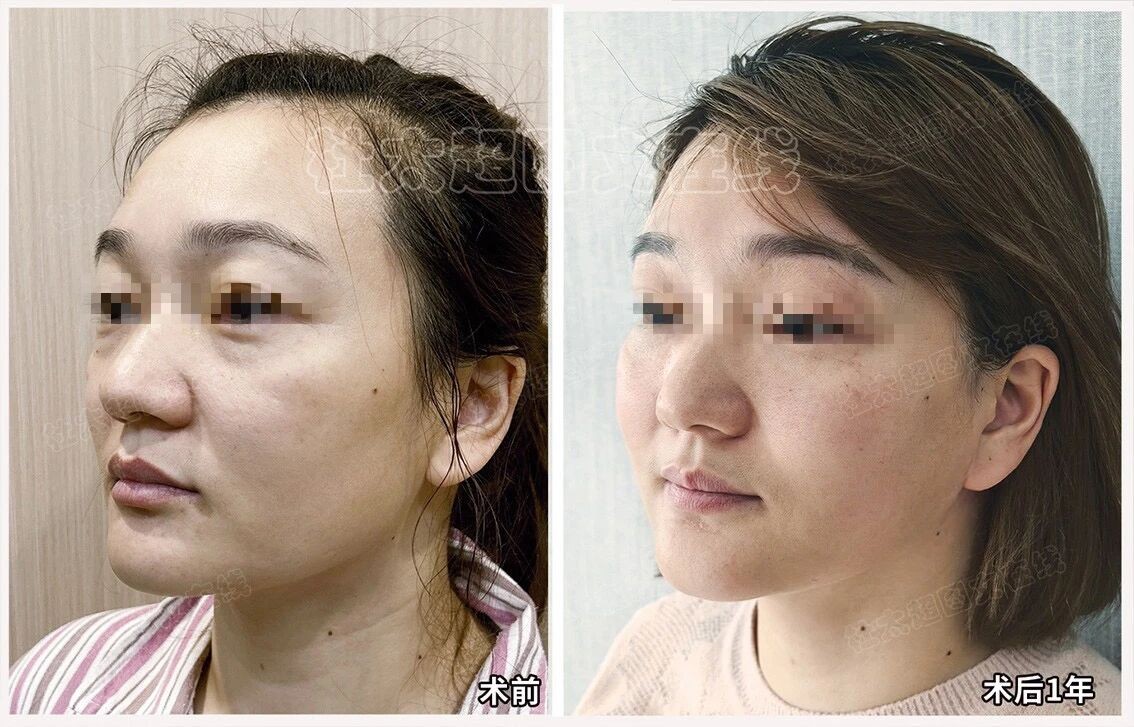 1756869693250293.jpg 微信图片_2025-09-03_111811_898.jpg