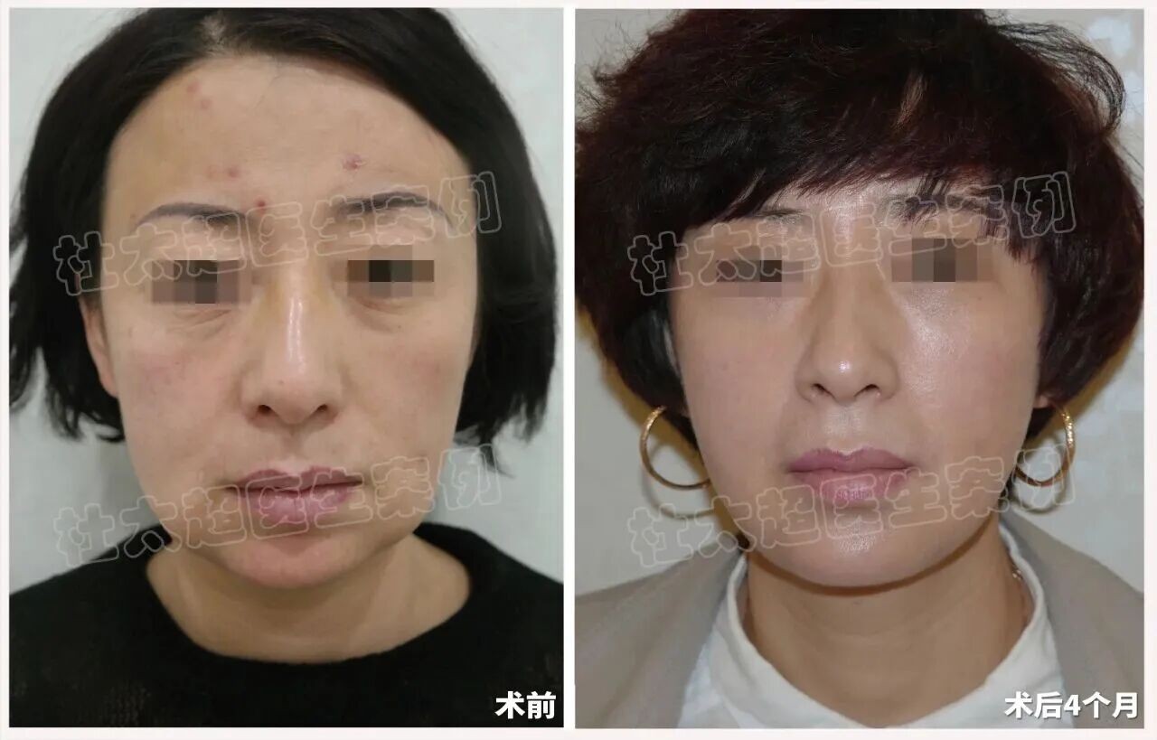 1757069521210050.jpg 微信图片_2025-09-05_184915_300.jpg