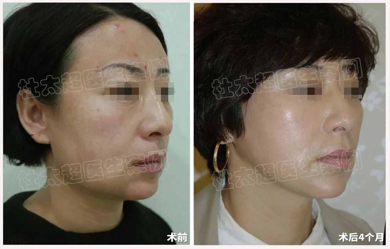 1757069542595702.jpg 微信图片_2025-09-05_184928_763.jpg