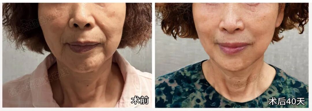 1757409162923016.jpg 微信图片_2025-09-09_170808_173.jpg