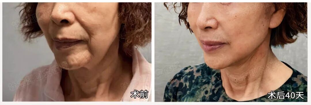 1757409173162953.jpg 微信图片_2025-09-09_170812_447.jpg