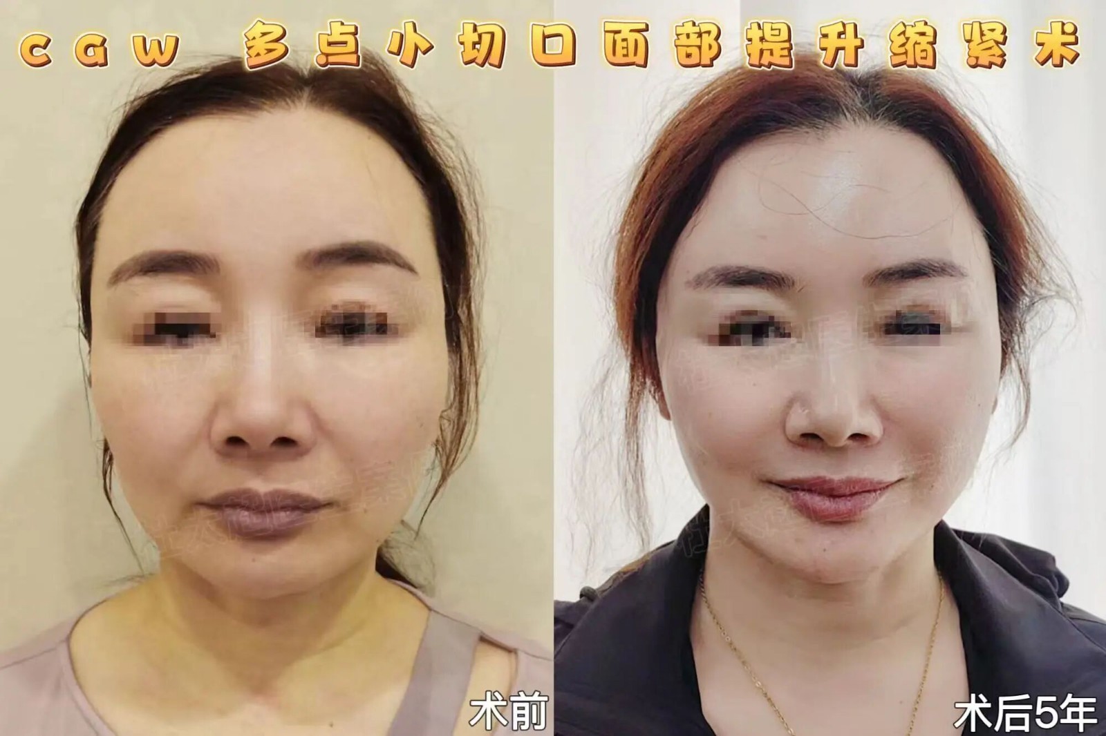 1757987733339082.jpg 微信图片_2025-09-16_094826_755.jpg