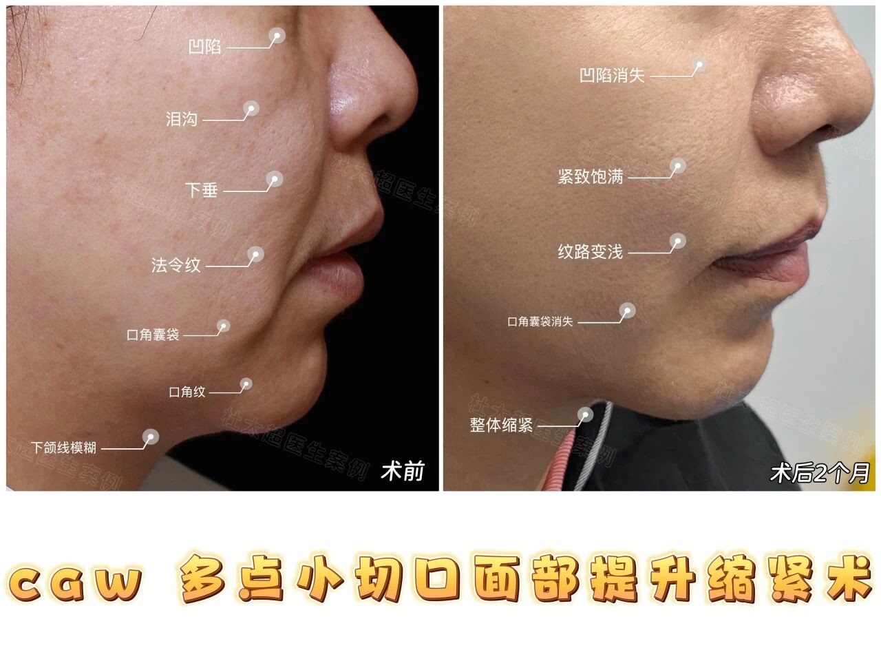 1758189964708627.jpg 微信图片_2025-09-18_175746_727.jpg