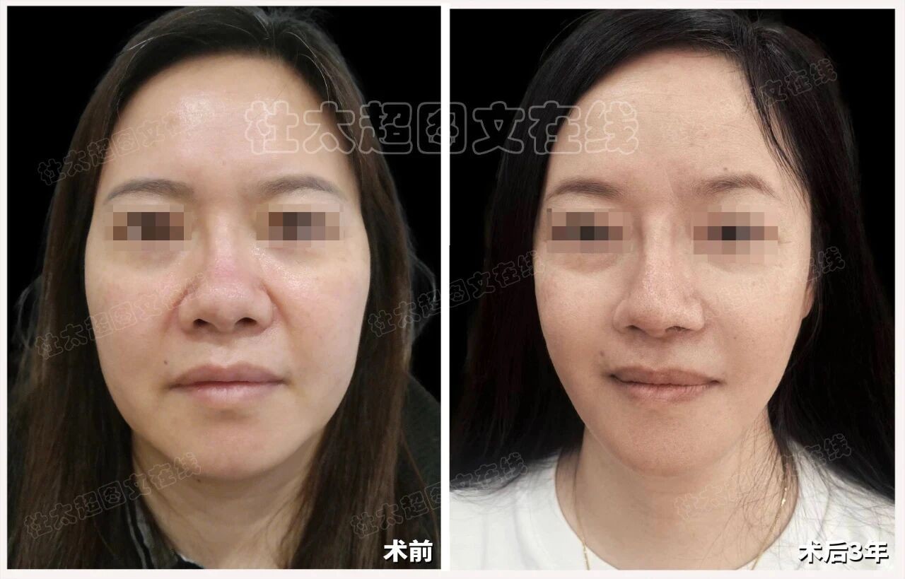 1758360880202051.jpg 微信图片_2025-09-20_172931_390.jpg