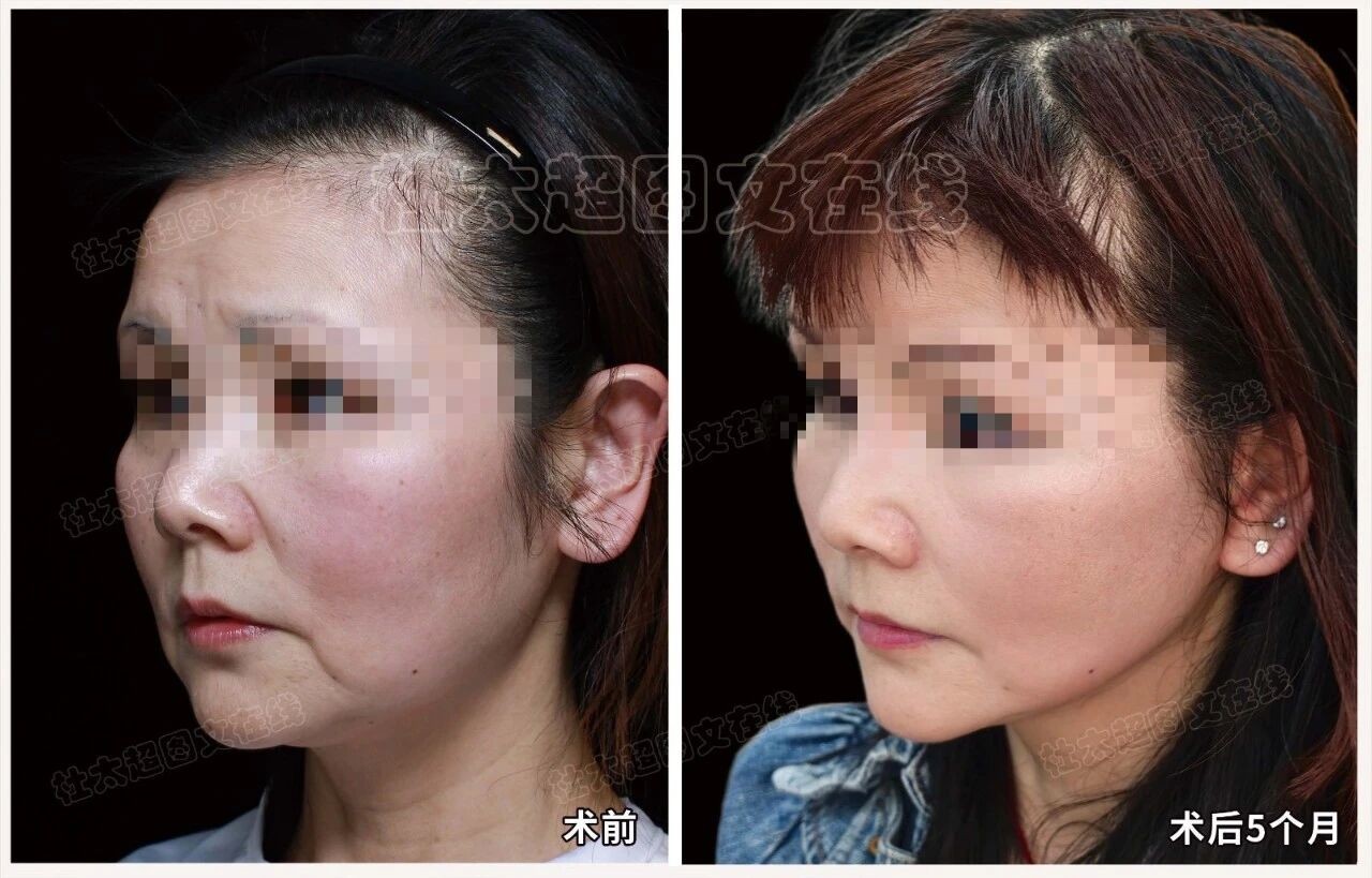 1758535776200195.jpg 微信图片_2025-09-22_180624_935.jpg