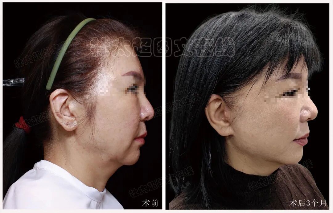 1761212027193888.jpg 微信图片_2025-10-23_173009_307.jpg