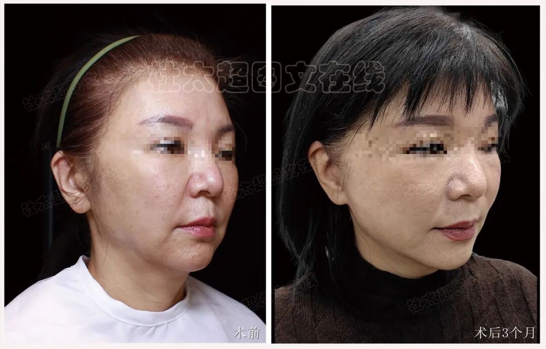 1761212015517966.jpg 微信图片_2025-10-23_173007_726.jpg