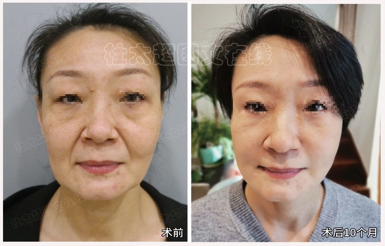 1761562915112031.jpg 微信图片_2025-10-27_171451_063.jpg