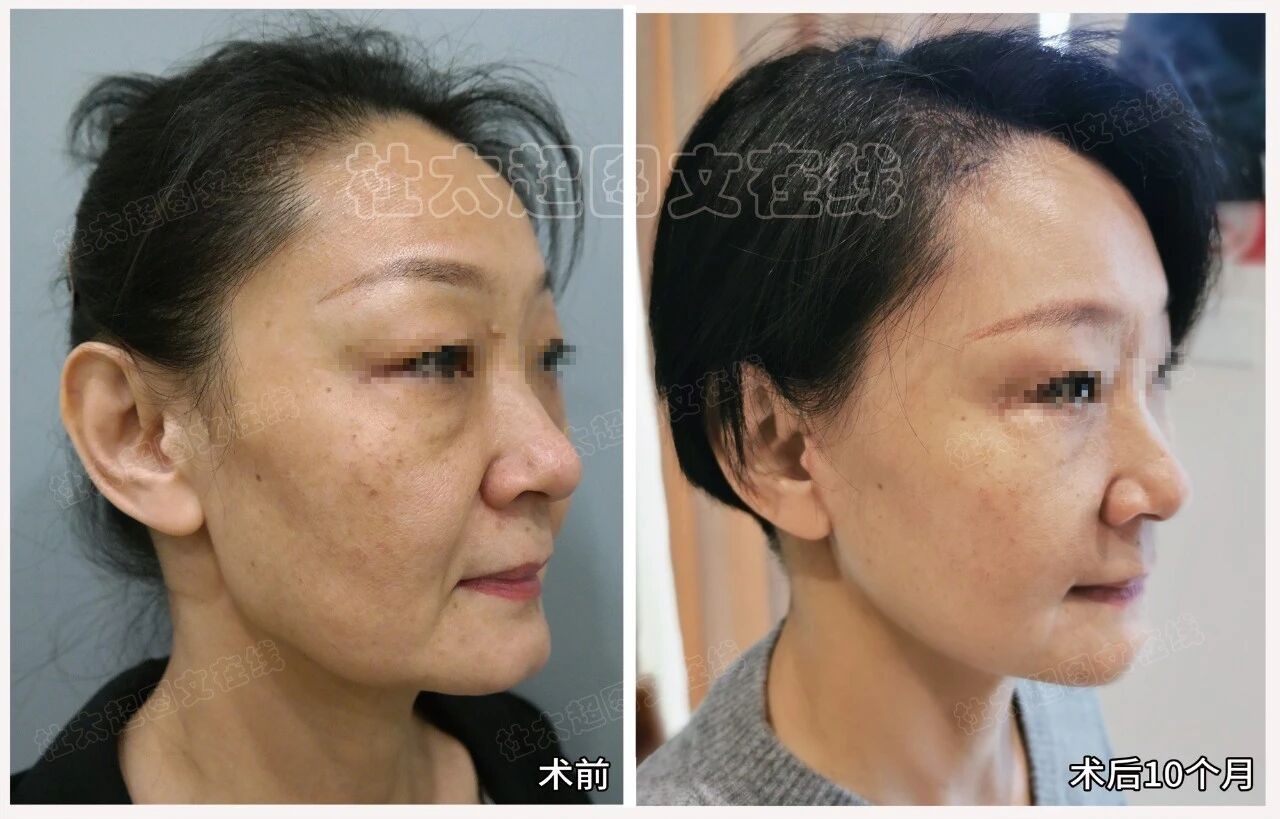 1761562915201134.jpg 微信图片_2025-10-27_171452_958.jpg