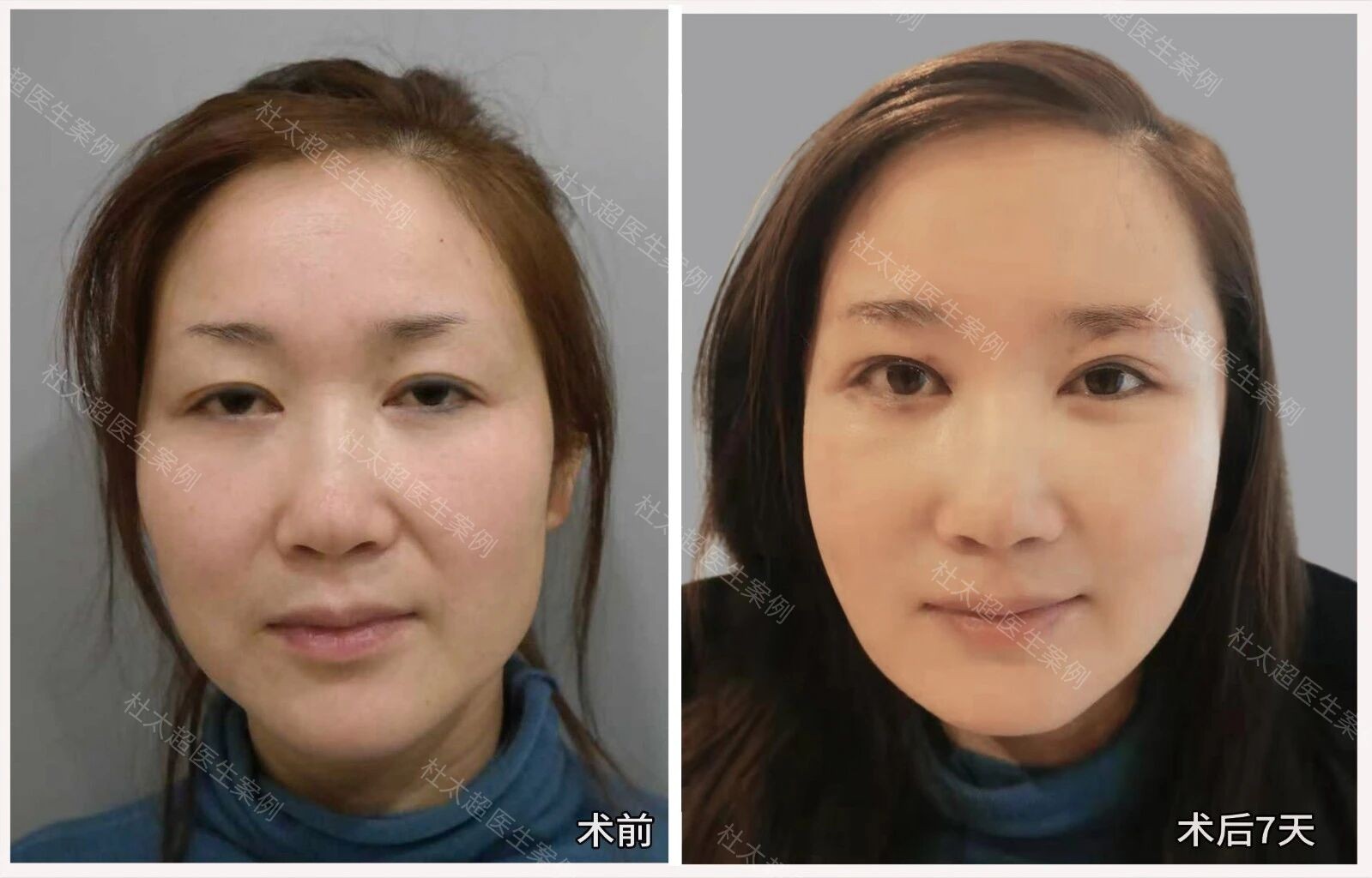 1762593650699512.jpg 微信图片_2025-11-08_171048_056.jpg