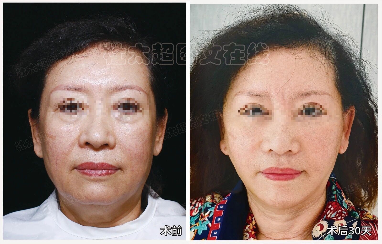 1763716462696865.jpg 微信图片_2025-11-21_171044_471.jpg