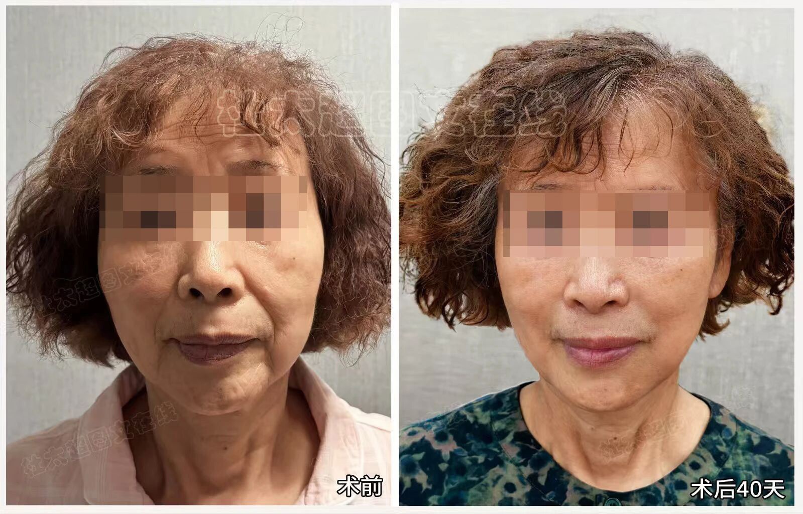 1769683850108044.jpg 微信图片_2026-01-29_184642_348.jpg