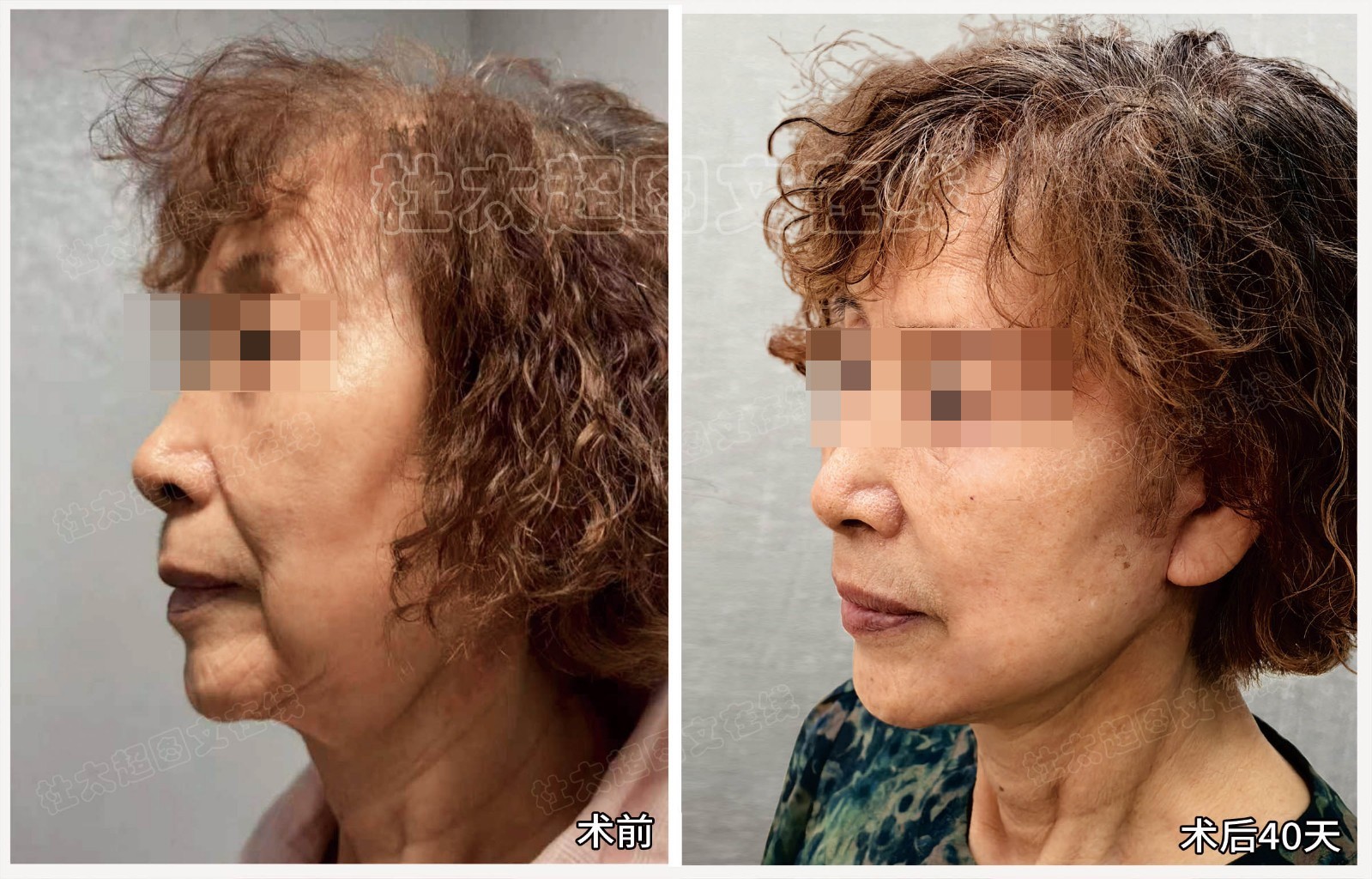 1769683871150680.jpg 微信图片_2026-01-29_184644_513.jpg