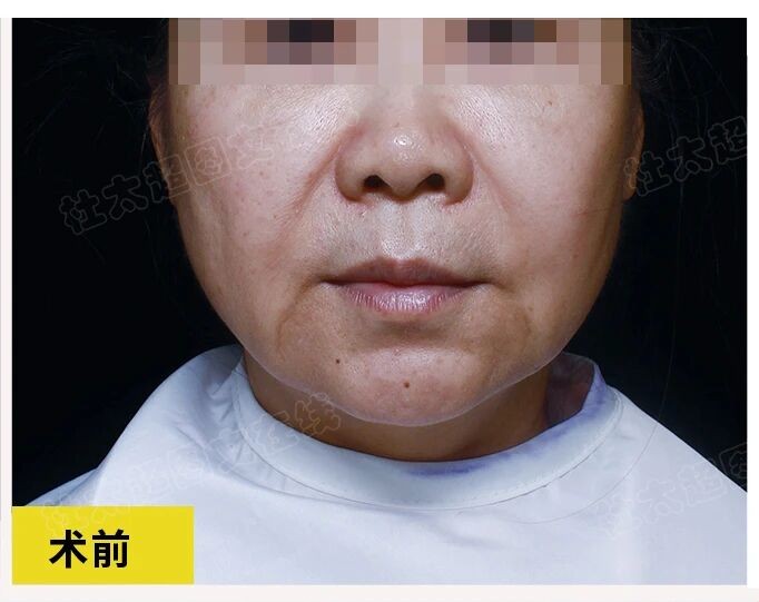 1772184812215902.jpg 微信图片_2026-02-27_173003_716.jpg