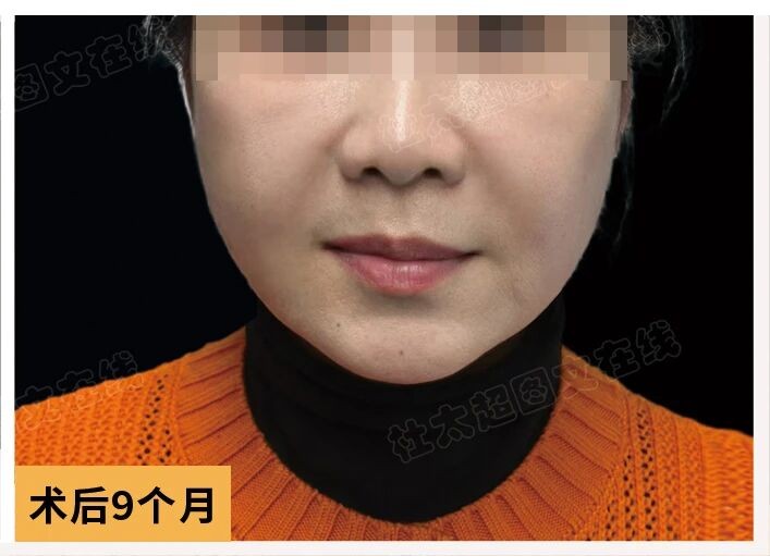 1772184828583014.jpg 微信图片_2026-02-27_173013_526.jpg