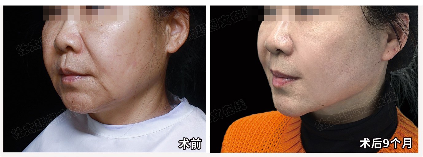 1772184862126124.jpg 微信图片_2026-02-27_173017_813.jpg