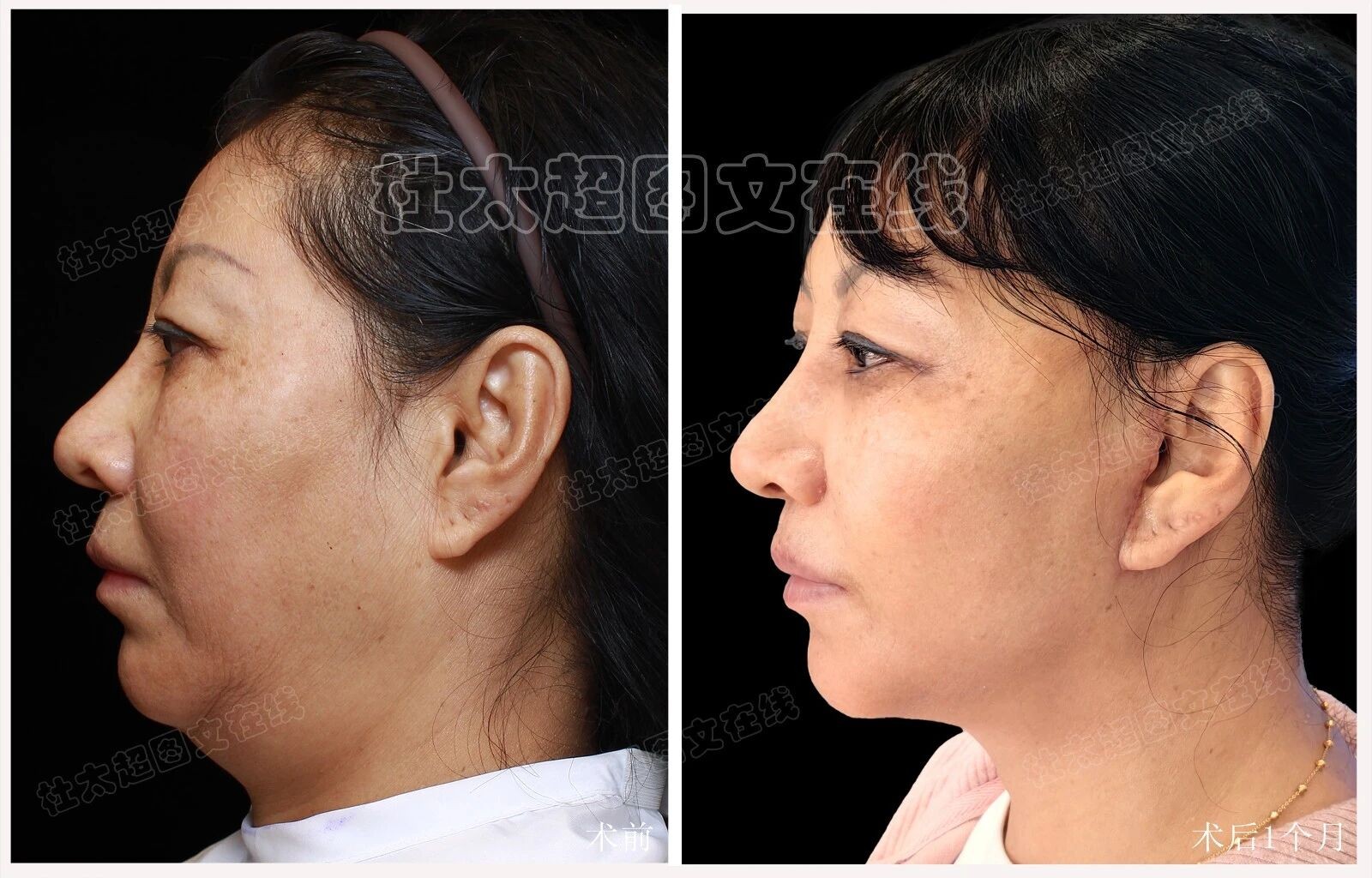 1772246406856736.jpg 微信图片_2026-02-28_100837_661.jpg