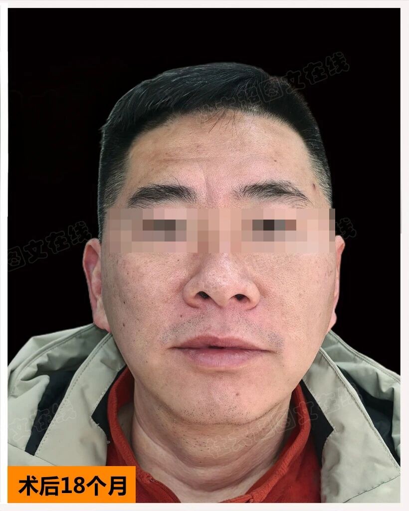 1772271165206145.jpg 微信图片_2026-02-28_172647_257.jpg