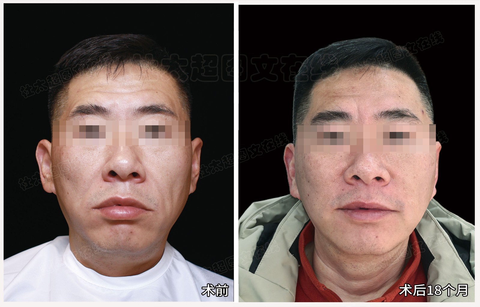 1772271173178332.jpg 微信图片_2026-02-28_172649_087.jpg