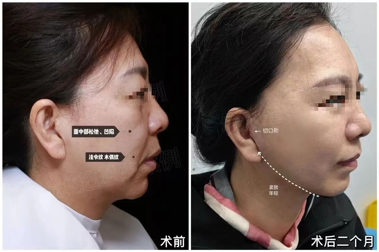 1772344135201408.jpg 微信图片_2026-03-01_133118_454.jpg