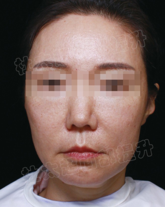 1773660434822318.jpg 微信图片_2026-03-16_191529_077.jpg