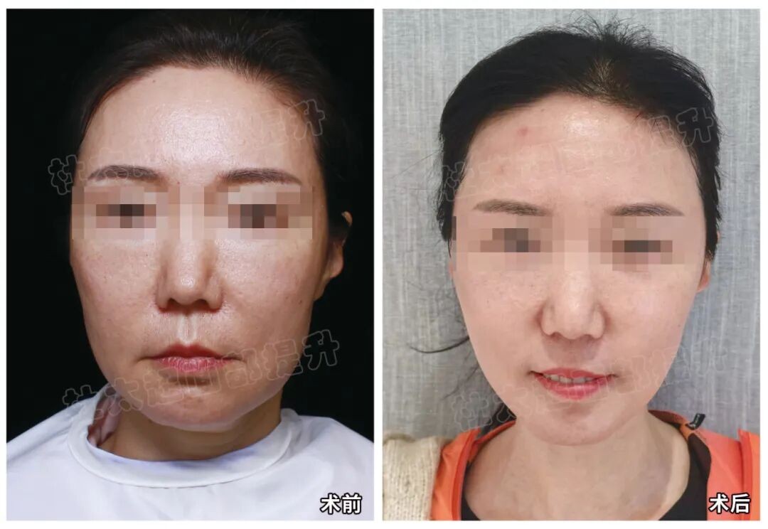 1773660446188725.jpg 微信图片_2026-03-16_191532_060.jpg