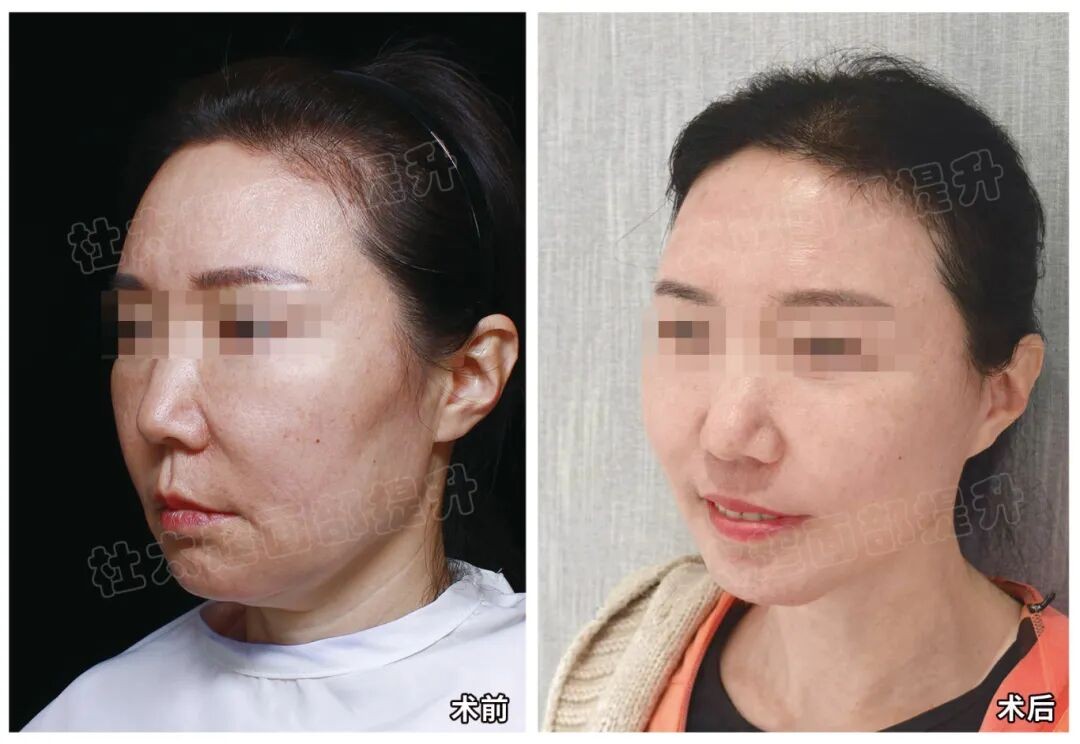 1773660446735824.jpg 微信图片_2026-03-16_191533_857.jpg