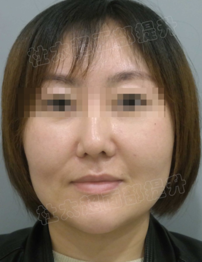 1773996572143767.jpg 微信图片_2026-03-20_164607_768.jpg