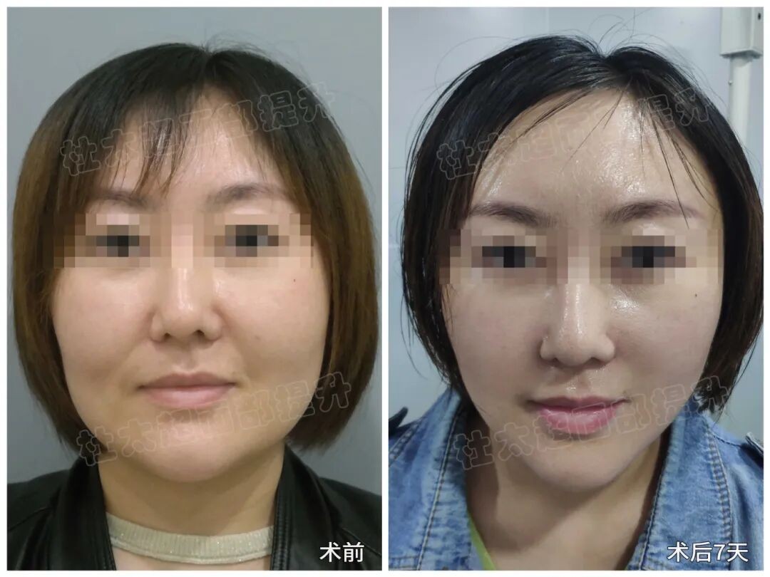 1773996626202558.jpg 微信图片_2026-03-20_164621_208.jpg