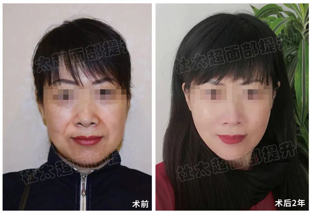 1774097290105437.jpg 微信图片_2026-03-21_204705_223.jpg