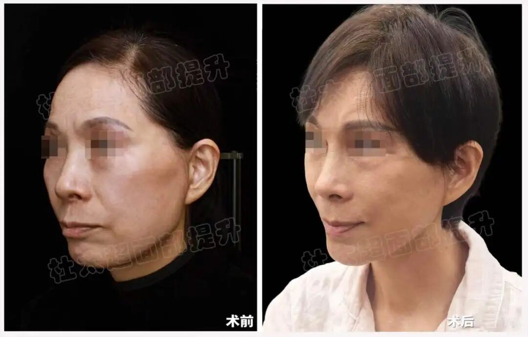 1774258422813436.jpg 微信图片_2026-03-23_173135_643.jpg