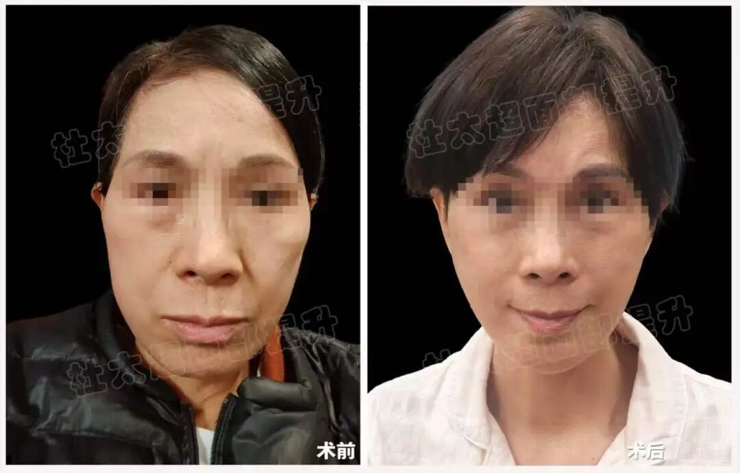 1774258446879029.jpg 微信图片_2026-03-23_173122_689.jpg