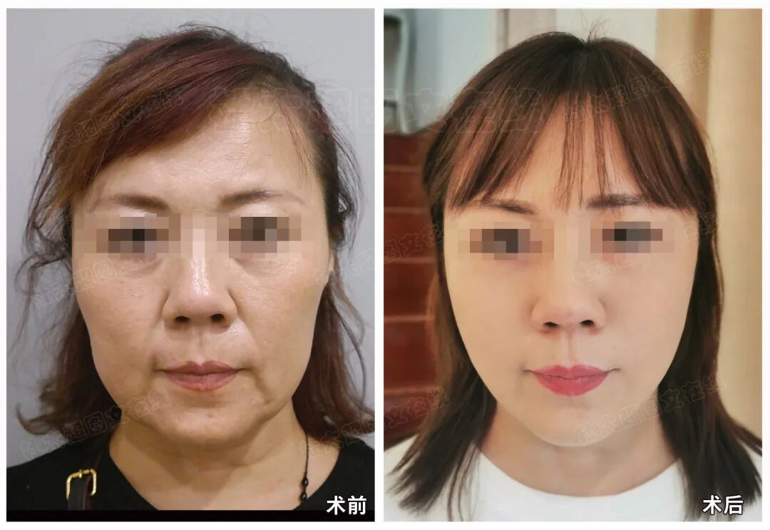 1775553772179074.jpg 微信图片_2026-04-07_171755_123.jpg