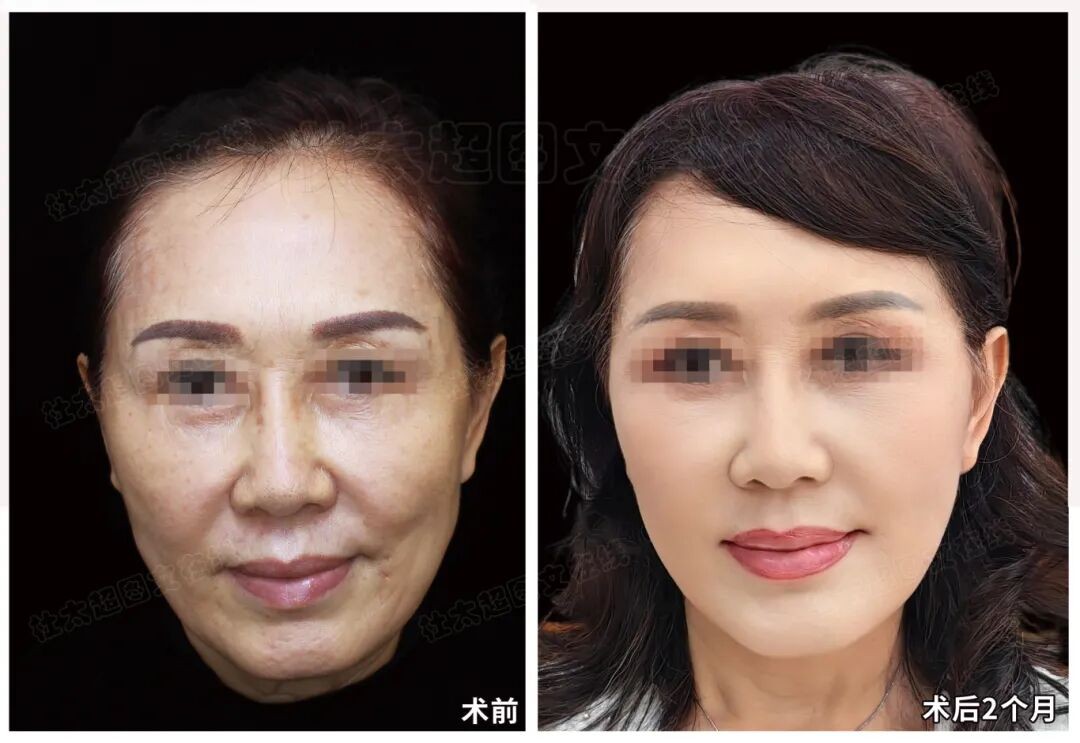 1775730274600333.jpg 微信图片_2026-04-09_182246_097.jpg