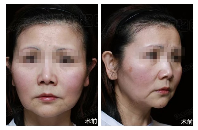 1776162279151218.jpg 微信图片_2026-04-14_182149_938.jpg