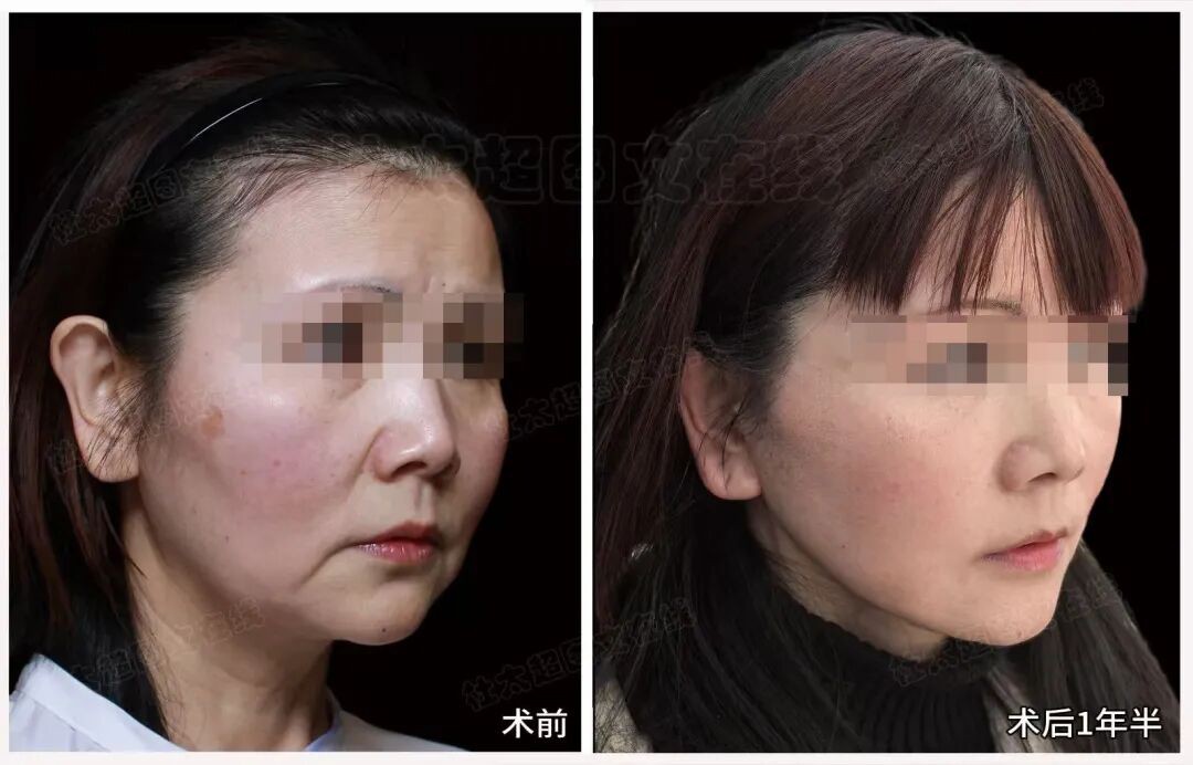 1776162328117399.jpg 微信图片_2026-04-14_182137_802.jpg