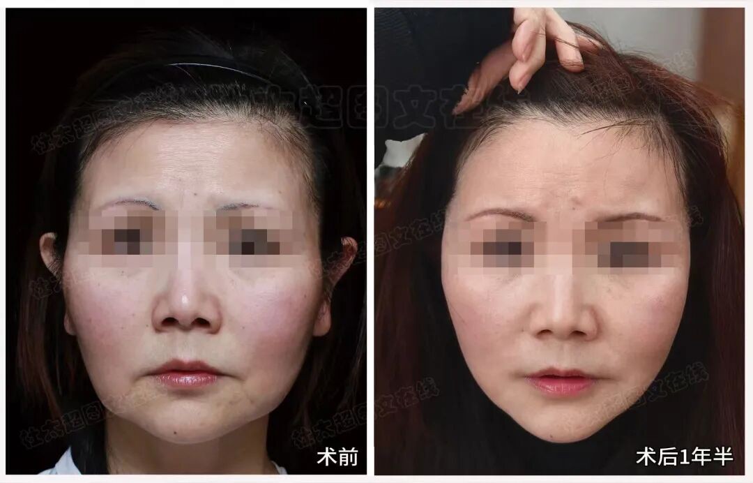 1776162361464506.jpg 微信图片_2026-04-14_182139_589.jpg