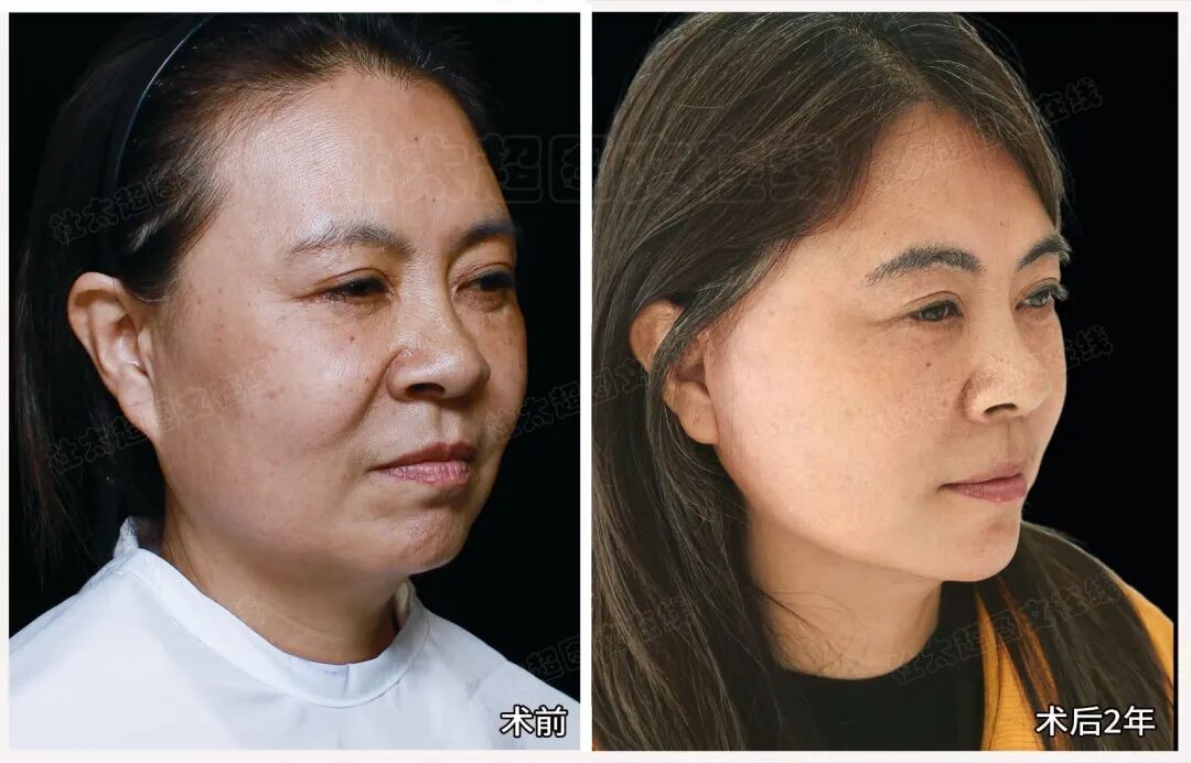 1776247112128761.jpg 微信图片_2026-04-15_175456_870.jpg